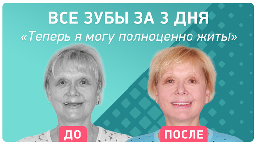 Video herunterladen: Восстановление зубов на имплантах за 3 дня – плюсы и минусы, отзыв реального пациента