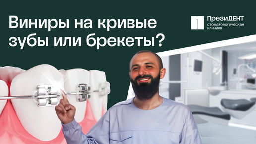 Download Video: Виниры на кривые зубы. Кому нельзя и можно ставить вниры? Виниры на кривые зубы до и после.