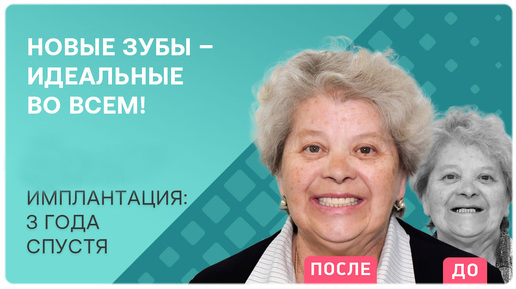 Имплантация всех зубов вместо съемных протезов 👉 отзыв через 3 года