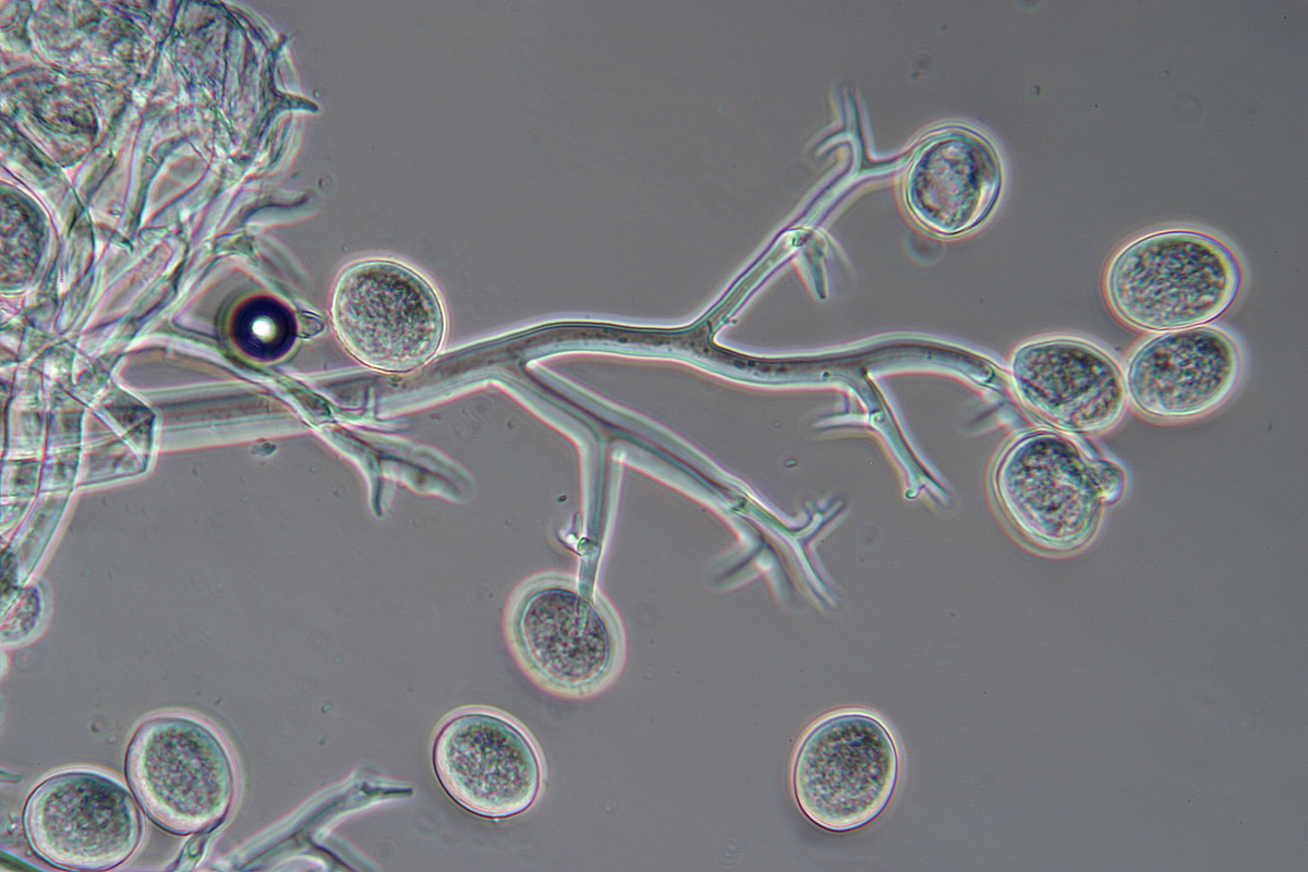 Конидии peronospora под микроскопом