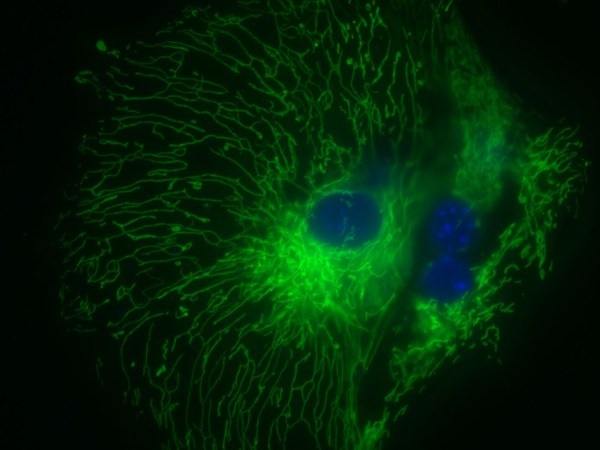 Так сеть ветвящихся митохондрий выглядит в мышином фибробласте. Фото: NGFN.