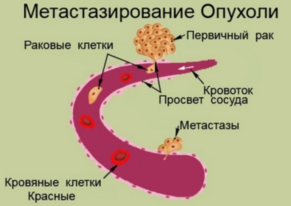 Из открытого источника в интернете