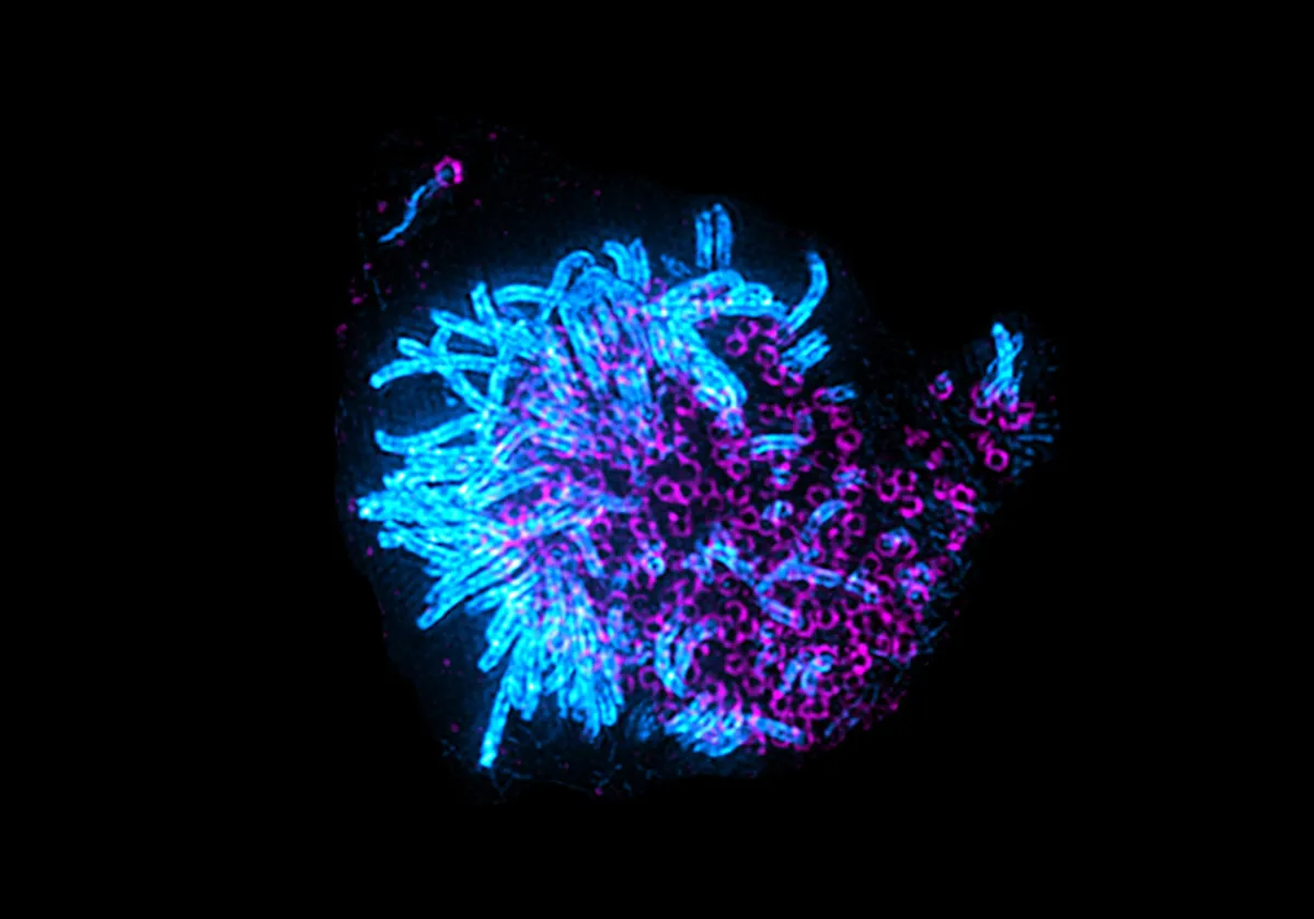 На микрофотографии со сверхразрешением изображены две клетки дыхательных путей, которые окрашены по центриолям (пурпурный цвет) и ресничкам (голубой цвет). Первичная реснитчатая клетка (слева) - это клетка-предшественник, в которой зарождается цикл мультицилиации. Дифференцированная клетка (справа) имеет сотни центриолей и ресничек в результате цикла мультицилиации. Фото: Semil Choksi