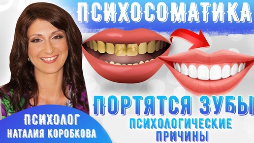 Download Video: Плохие зубы, часто портятся зубы: причины #психосоматика