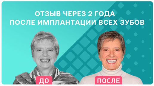 下载视频: Как работает комплексная имплантация