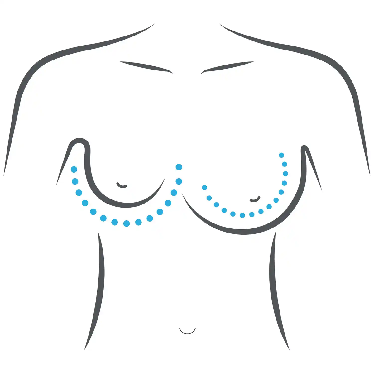 https://www.drcapone.com/services/breast-asymmetry-correction