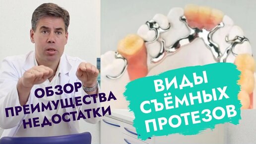 Download Video: Удобство, функциональность, эстетика и стоимость съёмных протезов зависят от этих особенностей.