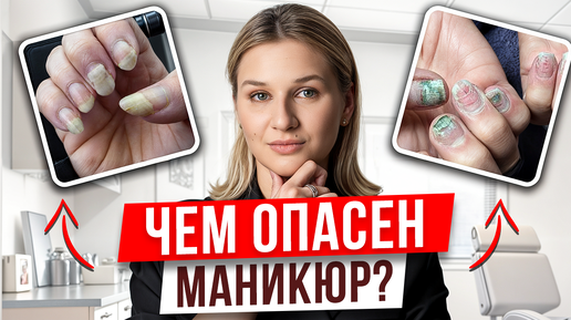 СТРАШНЫЕ последствия маникюра, после которых вы перестанете его делать! / Что такое онихолизис и как его избежать?