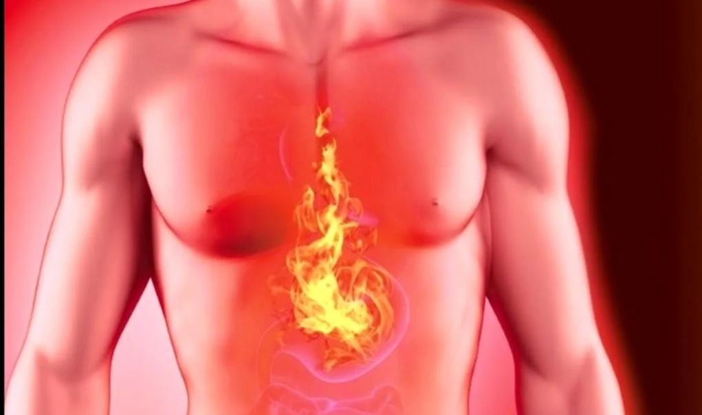 Картинка из интернета