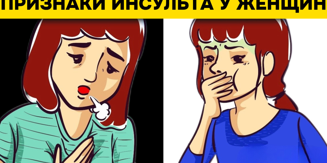 10 необычных признаков инсульта у женщин, которые могут быть едва заметны