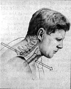 Первый выстрел. Фото с Wikipedia.org
