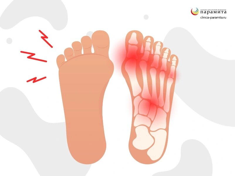 Артрит большого пальца ноги