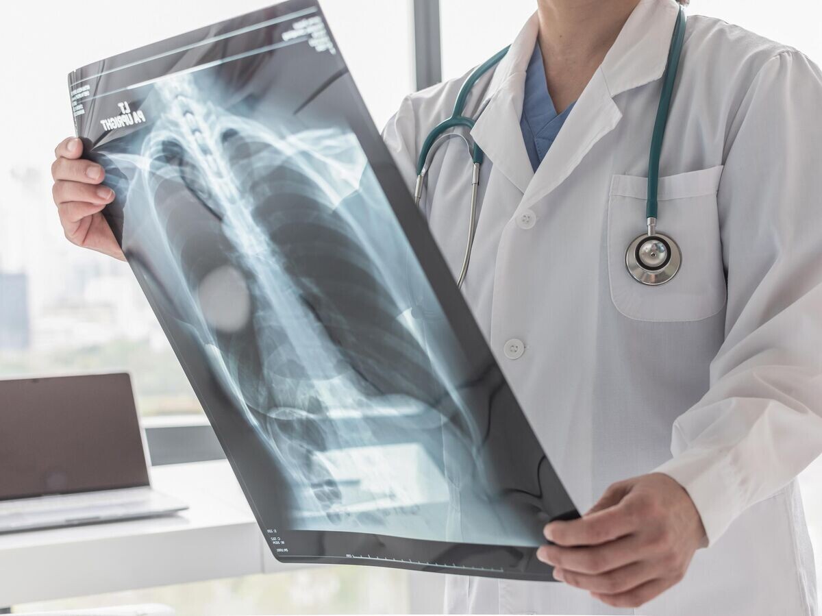    Врач изучает рентгеновский снимок грудной клетки пациента © iStock.com / Chinnapong