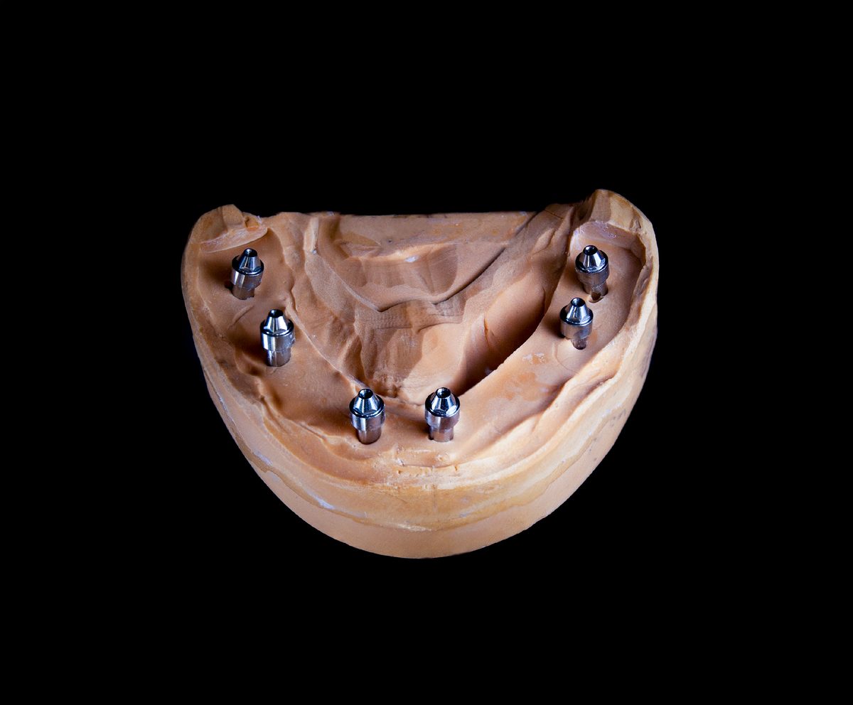 Установленные на аналоги имплантатов мультиюниты.