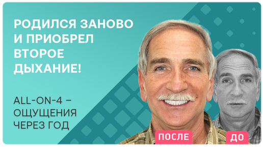 Все зубы all-on-4 👉 отзыв пациента через год после имплантации