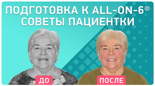 Имплантация all-on-6: максимально полный и подробный отзыв пациентки. Как проходила операция