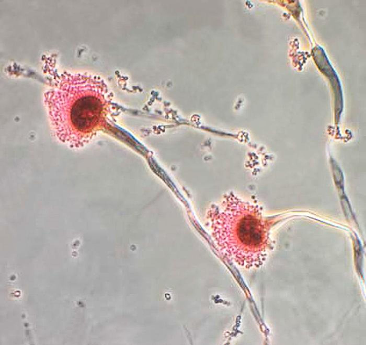 A photomicrograph of the fungus Aspergillus fumigatus. / Credit: CDC 
