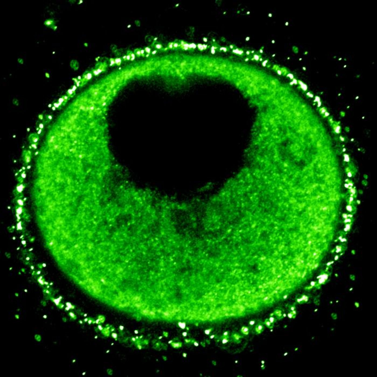 Sea star (Patiria miniata) oocyte with fluorescent Vitellogenin-GFP. / Credit: D. Nathaniel Clarke 
