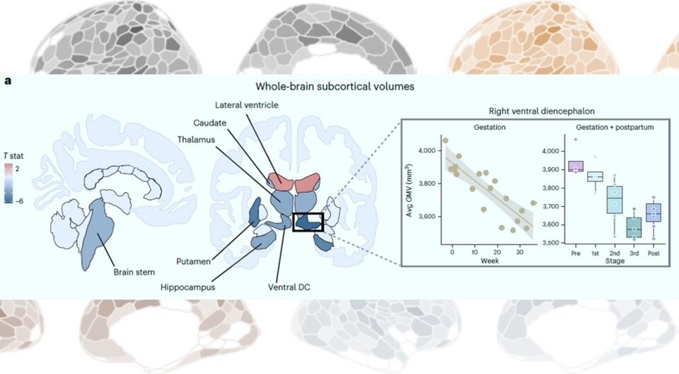   Laura Pritschet et al. / Nature Neuroscience, 2024