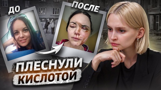 «Меня облили кислотой» | Кислотный маньяк из Монино