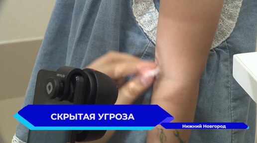 Как снизить факторы риска и куда обращаться, если родинка стала беспокоить?