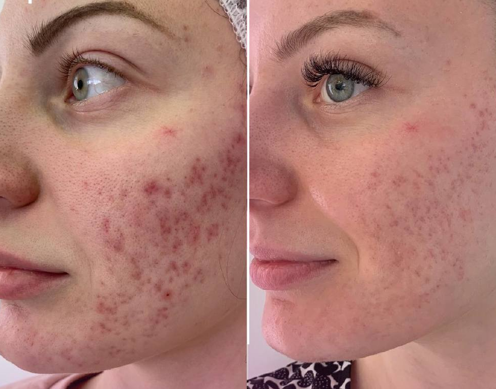 Комплексные и индивидуальные решения в клинике Telo's Beauty