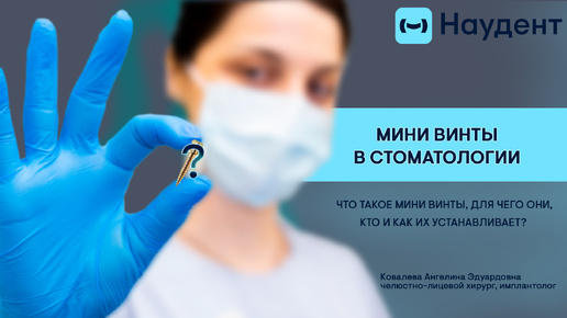 Мини винты в стоматологии - что это, для чего нужно, кто и как их устанавливает?