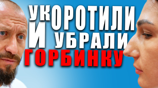 БЕЗ ГЕОМЕТРИИ НОС НОСИКОМ НЕ СДЕЛАЕШЬ / РИНОСЕПТОПЛАСТИКА В МАХАЧКАЛЕ / #ринопластика #пластиканоса