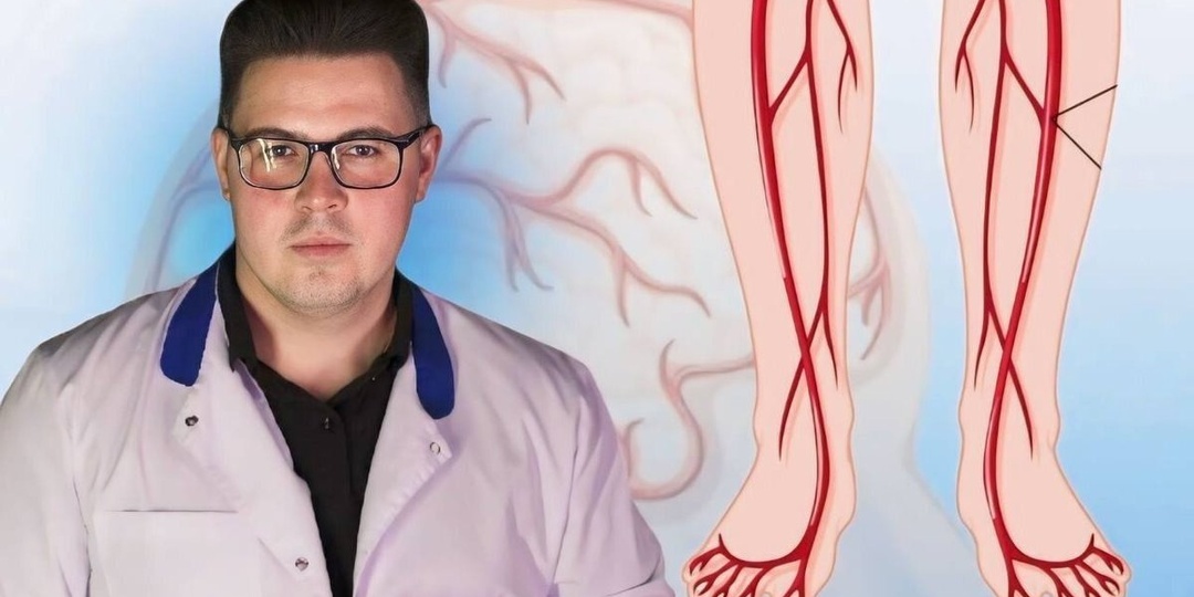 Ноги сигналят беду: 4 симптома, указывающих на атеросклероз сосудов