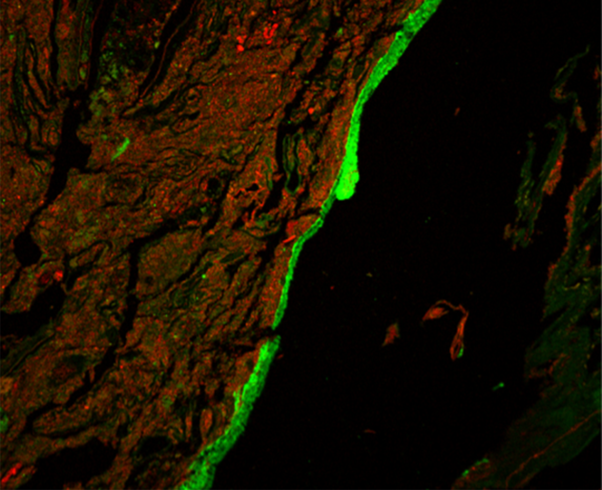 Слизистый барьер окрашен в зеленый цвет, бактерии - в красный. Фото: Bergstrom et al., Science