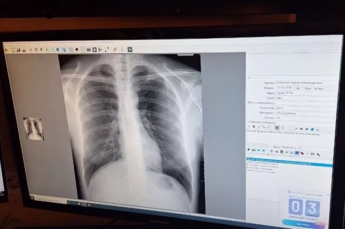    В Челябинске начали использовать искусственный интеллект для выявления рака