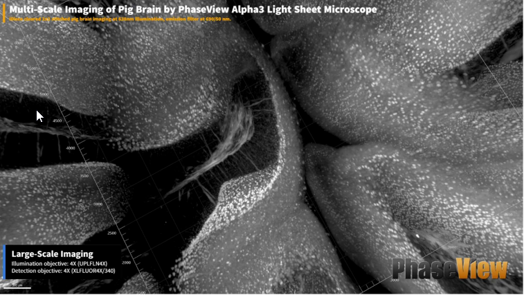 Многомасштабная визуализация мозга свиньи с использованием протокола iDisco 2x2 при освещении 638 нм, эмиссионный фильтр при 690/50 нм:  крупномасштабная визуализация, объектив освещения: 4X (UPLFLN4X), объектив обнаружения: 4X (XLFLUOR4X/340). 
Фото публикуется с разрешения доктора Александра Раппа, Технический университет Дармштадта, Германия.
Многомасштабная визуализация мозга свиньи с использованием протокола iDisco 2x2 при освещении 638 нм, эмиссионный фильтр при 690/50 нм: