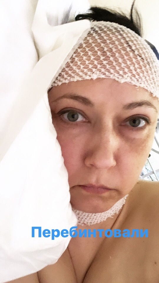  После второго. Кстати после второго таких глюков не было.