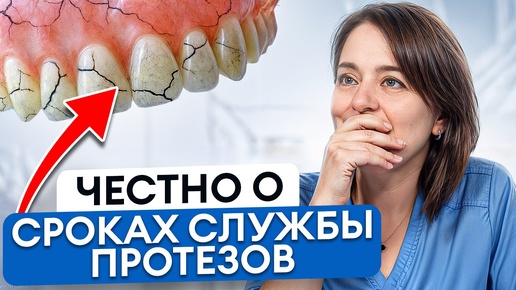 Download Video: Пломбы, виниры, коронки и импланты: сколько прослужат даже самые ХОРОШИЕ изделия?