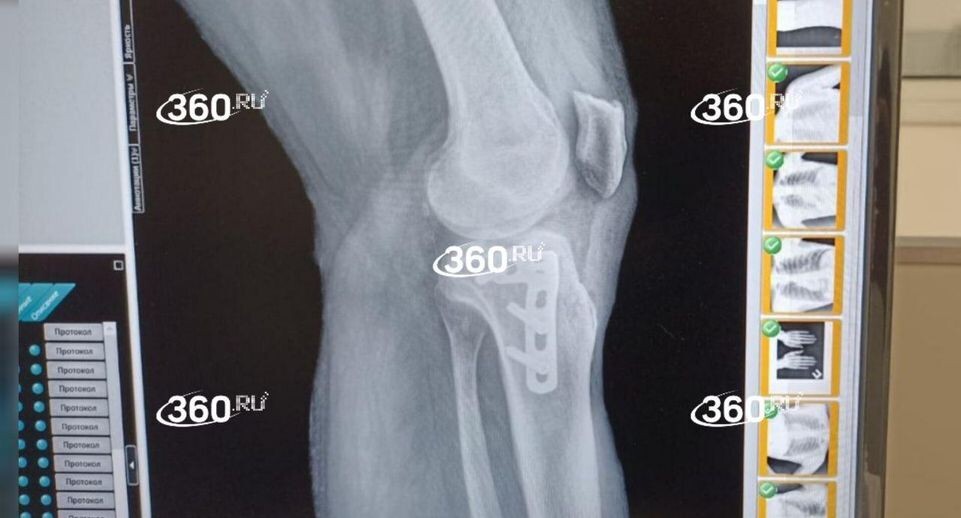     Телеканал «360»