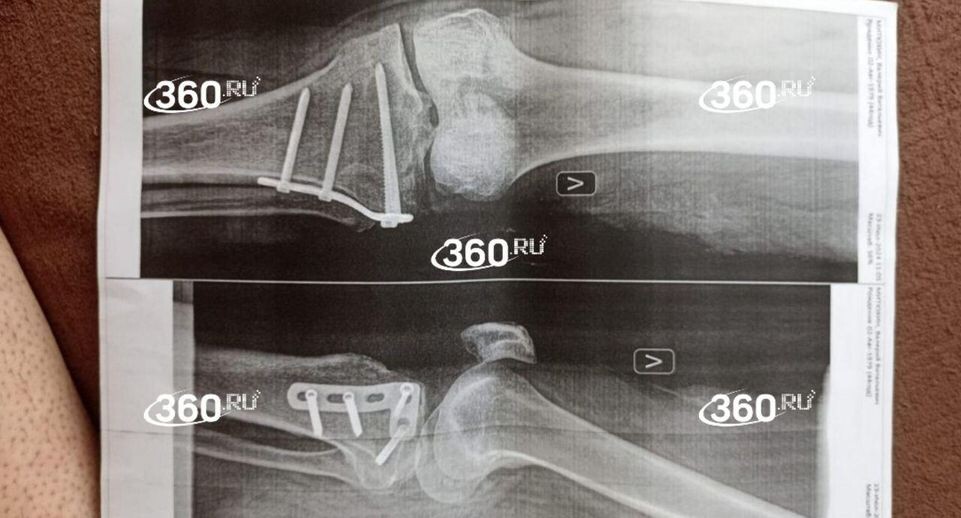     Телеканал «360»