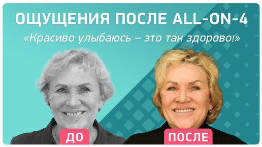 Омоложение после all-on-4: отзыв пациента о восстановлении всех зубов