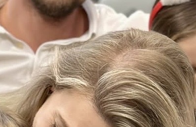 а тут уже лысинка скоро появится