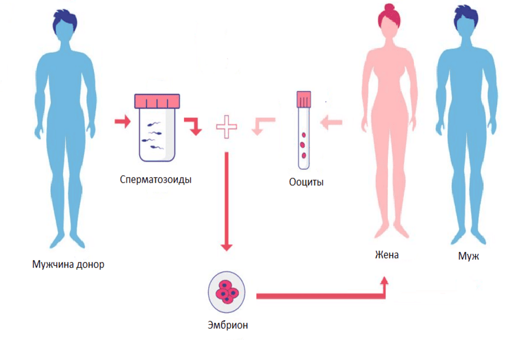 Донорство спермы и яйцеклеток