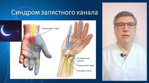 Почему немеют руки?