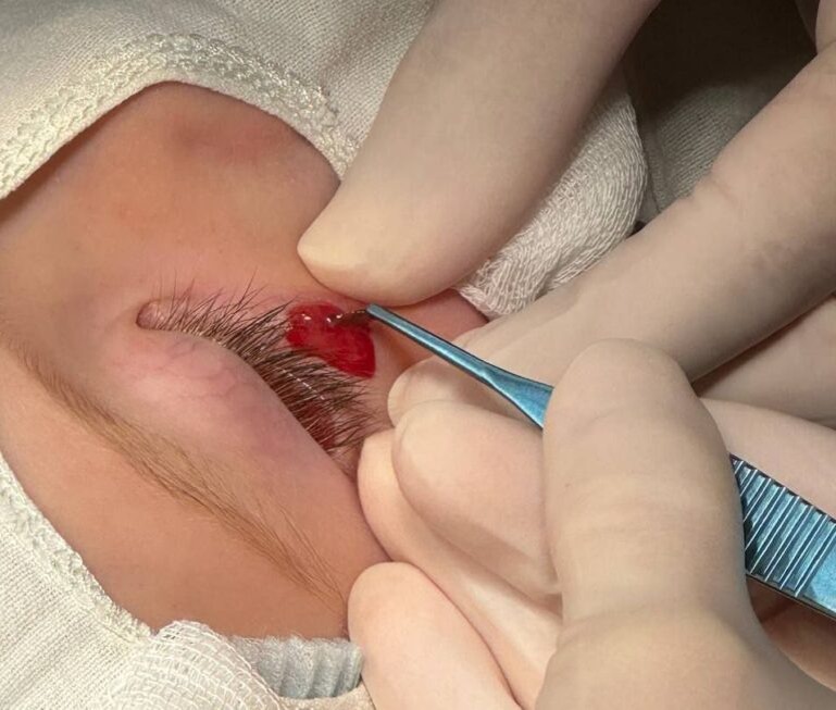    Оренбургские офтальмологи спасли глаз 1,5-годовалому малышу Кристина Просвиркина