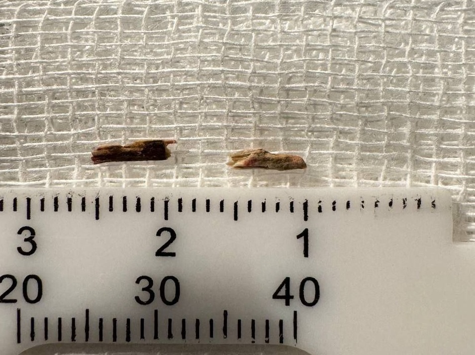    Оренбургские офтальмологи спасли глаз 1,5-годовалому малышу Кристина Просвиркина