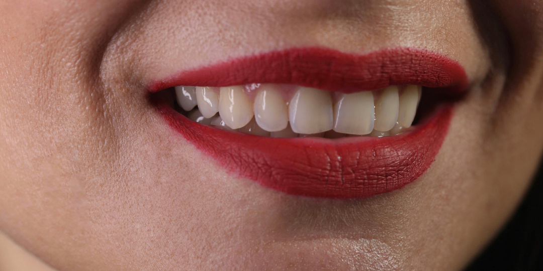 Корейские зубные имплантаты