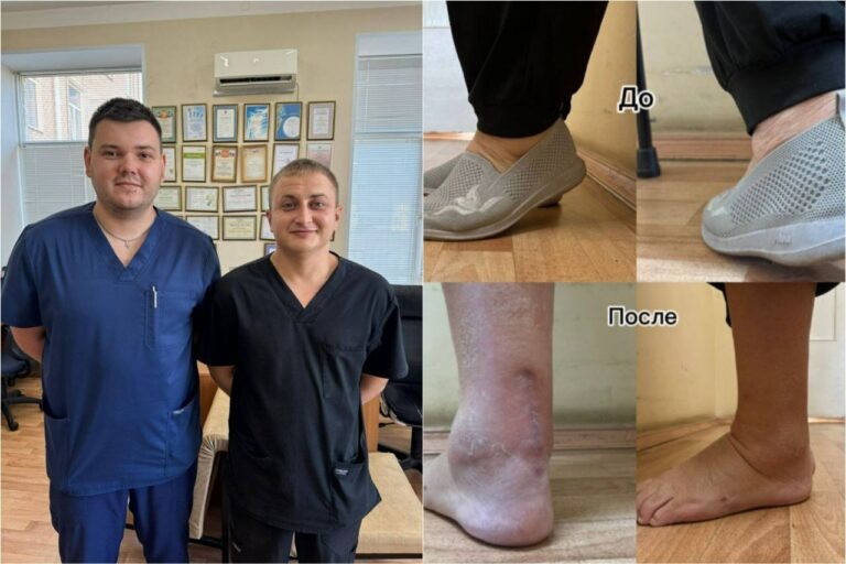    Оренбургские травматологи-ортопеды вернули пациентке возможность полноценно ходить Андрей Севостьянов