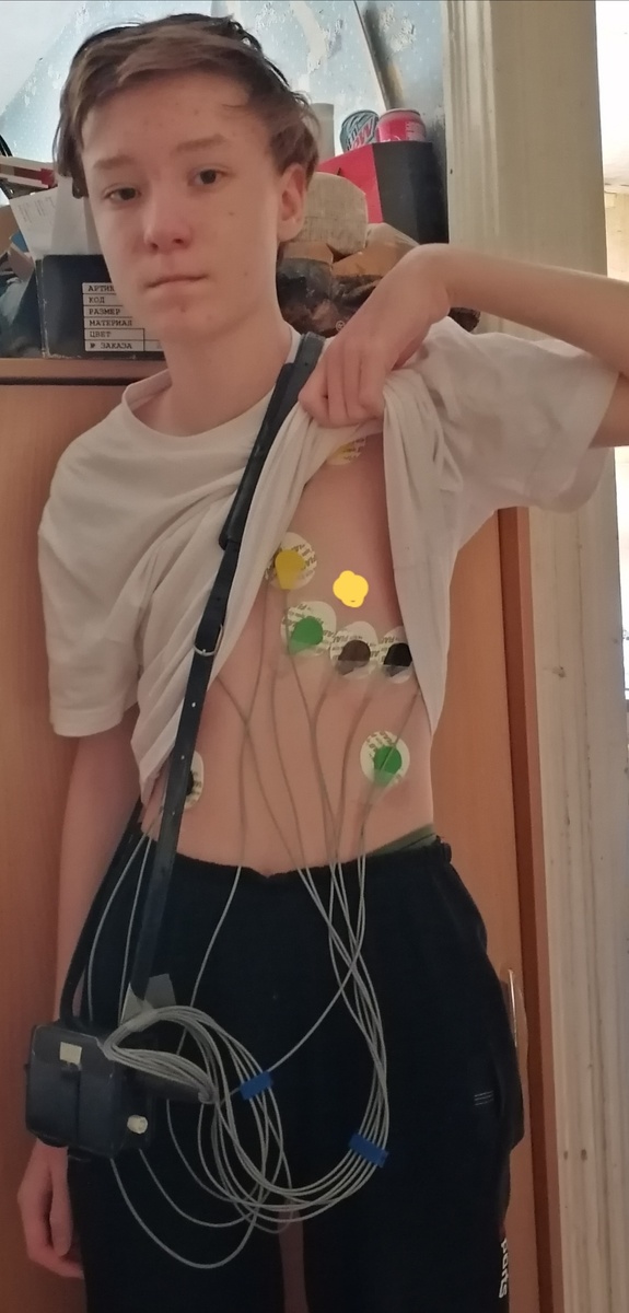 Это холтер. Фото из прошлого декабря