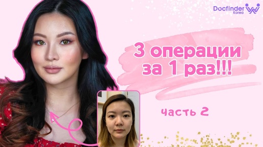 Визажист Emily Quak и её пластическая операция в Корее часть 2