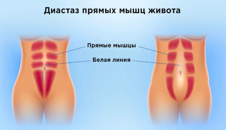 Фото - мсз.рф