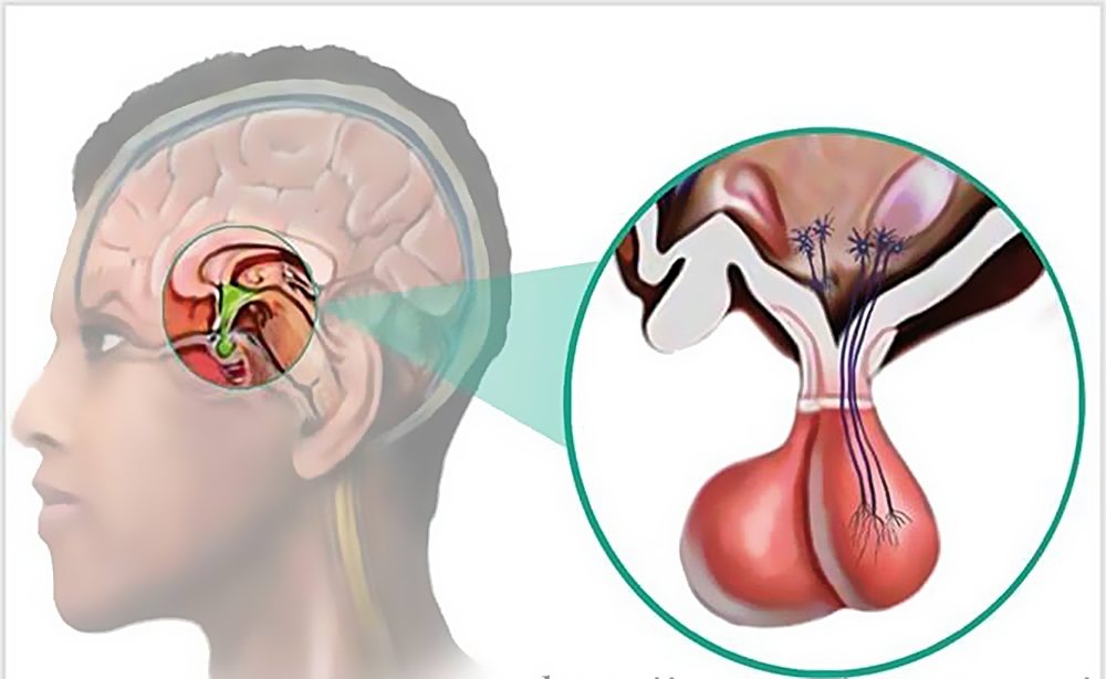 Схематичная локализация гипофиза в головном мозге для представления 