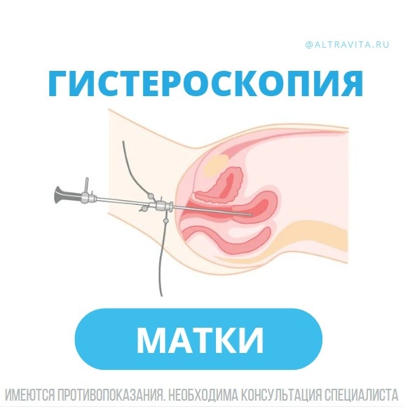 Офисная гистероскопия матки