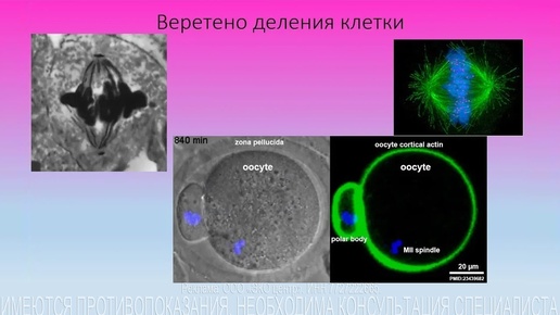 🔬 Оценка веретена деления яйцеклетки в ЭКО #яйцеклетка #репродукция #эко ИМЕЮТСЯ ПРОТИВОПОКАЗАНИЯ, НЕОБХОДИМА КОНСУЛЬТАЦИЯ СПЕЦИАЛИСТА